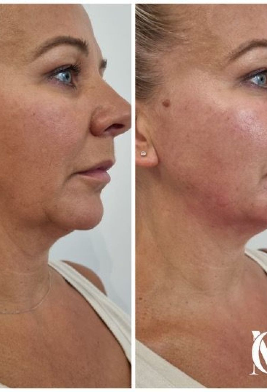 WhatsApp Image 2025-01-08 at 07.32.31 (1).jpeg